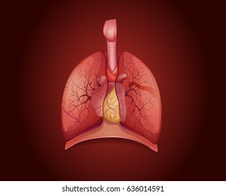 Diagram showing lungs with disease illustration