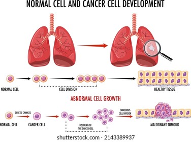 Diagram showing normal and cancer cells illustration