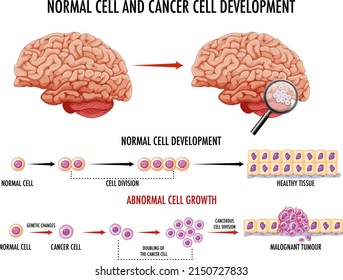 Diagram showing normal and cancer cells in human illustration