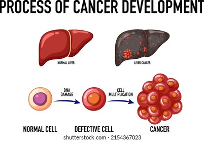 Diagram showing process of cancer development illustration