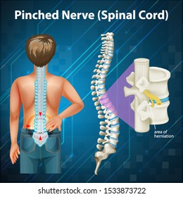 Diagram showing spinal cord illustration