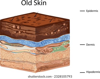 Diagram showing the structure of an old skin on a white background