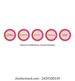 Diagram showing Vitamin A deficiency related ocular diseases - keratomalcia, xerophthalmia, night blindness, bitot's spots - simplified schematic diagram.