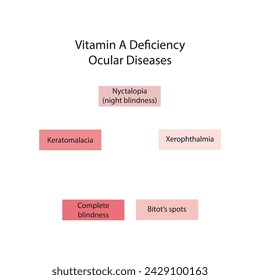 Diagram showing Vitamin A deficiency related ocular diseases - keratomalcia, xerophthalmia, night blindness, bitot's spots - simplified schematic diagram.