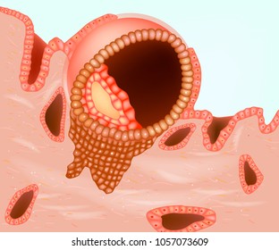 
The diagram shows an implanted embryo. Implantation and placentation. Prenatal development