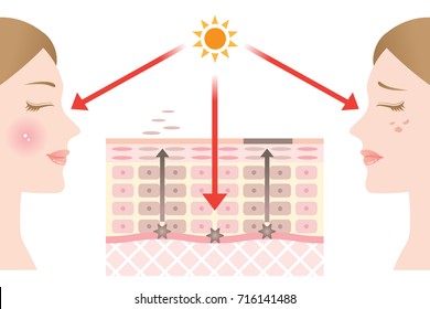 Diagram Of Skin Cell Turnover And Skin Spots Formation