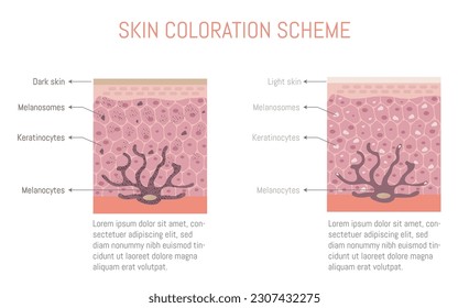 Diagram of skin coloration, for light and dark skin. Diagram of a melanocyte.