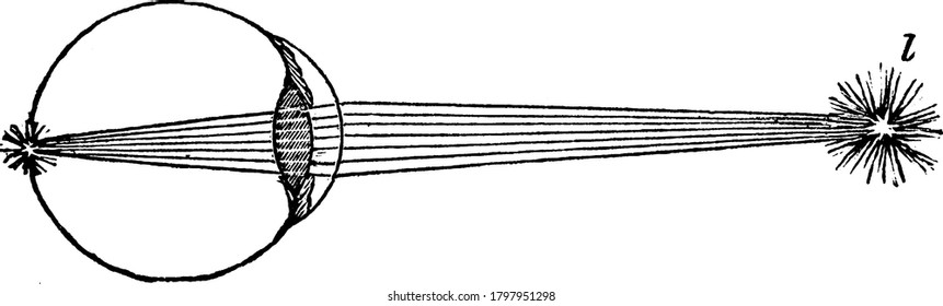 A Diagram That Depicts The Refraction By The Eye, With Its Parts Labelled, Vintage Line Drawing Or Engraving Illustration.