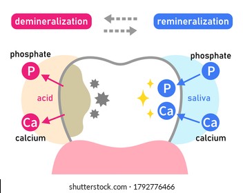 diagrama de desmineralización dental y rememoración. Concepto de cuidado dental