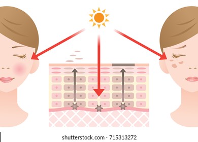 Diagram Of Turnover And Skin Spot Formation