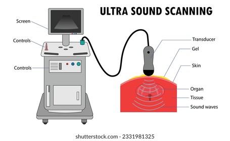 Diagram if the Ultrasound scanning device