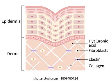 diagram of winkle skin showing the collagen framework is broken and wrinkles appears. Beauty skin care concept
