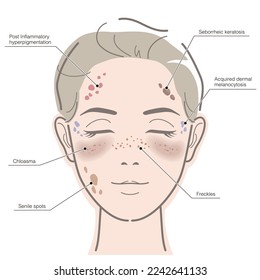 Diagrama de los puntos de edad facial de las mujeres. Ilustración vectorial aislada en fondo blanco.