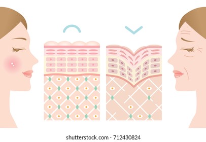 diagram of young and old skin. woman face with winkles and no winkle