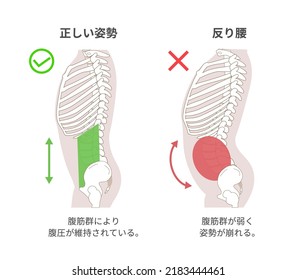 Diagrammatic illustration of the relationship between abdominal muscle groups, abdominal pressure, and posture, sideways[Translation: Illustration of the relationship between abdominal pressure and wa