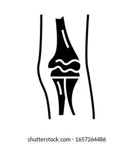 Diarthroses structure black icon, concept illustration, vector flat symbol, glyph sign.