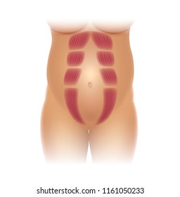 Diastasis Recti during pregnancy, also known as Diastasis Rectus Abdominus or abdominal separation, it is common among pregnant women and post birth. There is a gap between muscles.