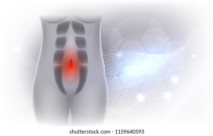 Diastasis Recti also known as Diastasis Rectus Abdominus or abdominal separation, it is common among pregnant women and post birth. There is a gap between the rectus abdominis muscles. 