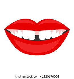 Diastema, Gap Between Teeth, Female Laughing Mouth. Vector Illustration