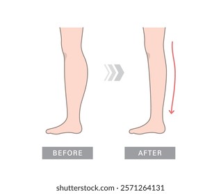 Diet before and after (leg thin). Fat obese leg and slim size leg comparison.