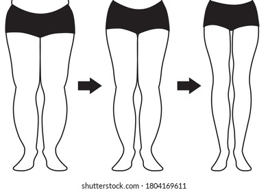 Diet developmental illustration
(Leg getting thin) 
Monochrome line drawing