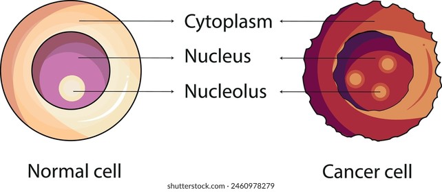 Differenz zwischen einem normalen und einem Krebszelldiagramm