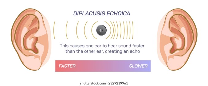 Difference between two ears, double hearing, density or pressure of sound, different frequency, compression, diplacusis dysharmonica and echoica. travelling sound wave, Dysharmonica and echoica. sound