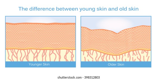 The difference between young skin and old skin. This illustration about skincare.