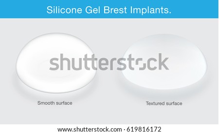 Difference of breast implant texture. This illustration about cosmetic surgery.