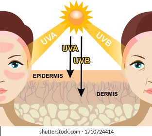 The difference of radiation 2 types in sunlight which is harmful to the skin. Infographic illustration of difference between UVA and UVB rays. UV penetration into human skin and woman face.