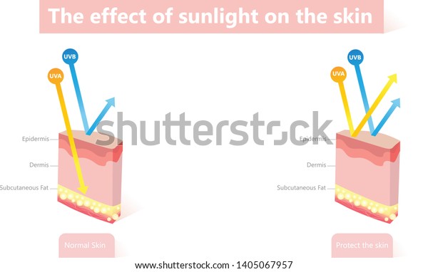 Difference Radiation 2 Types Sunlight Which Stock Vector (Royalty Free ...