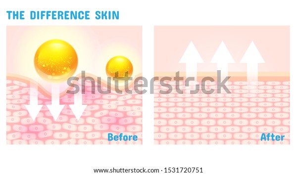 Difference Skin Structure Before After Vitamin Stock Vector (Royalty ...