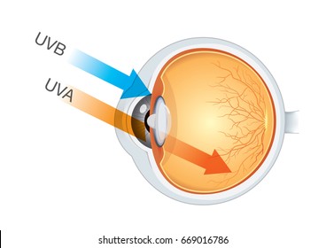 The difference of UVA and UVB from sunlight into eyes.. Illustration about medical and health.