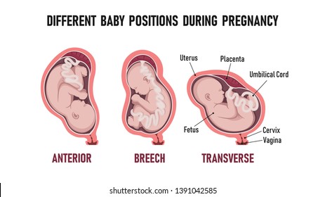 Different baby positions during  pregnancy