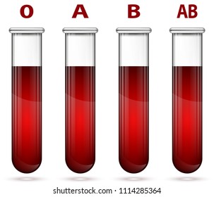 Diferentes tipos de sangre en la ilustración del tubo de ensayo