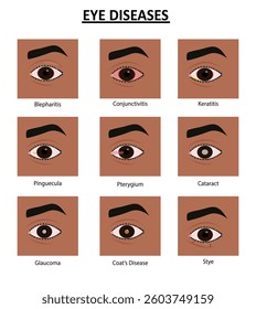 Different eye diseases vector illustration