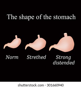 Different forms of the stomach. Vector illustration on a black background.