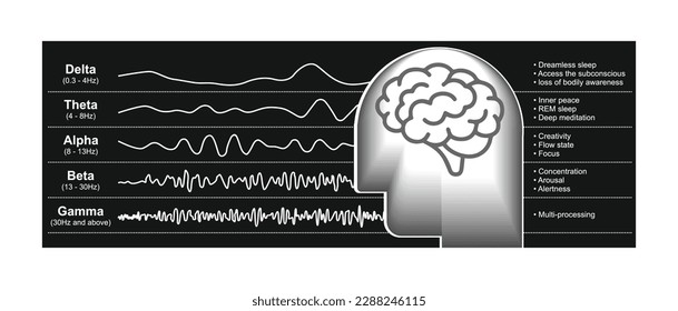 Different kinds of waveforms are produced by brain activity. Demonstration of human brain waves patterns