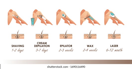 Different methods of hair removal. Shaver, depilatory cream, epilator, wax and laser. Types of epilation with timeline actions. For your design