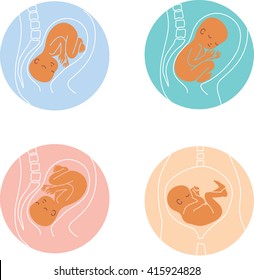 Different positions of baby in womb. vector