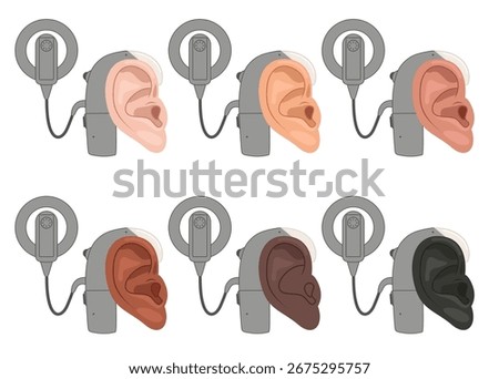 Different skin colors. Ear with cochlear implant device  for the hearing impaired and the deaf. Concept hearing aids, treatment of deafness.
Flat vector illustration