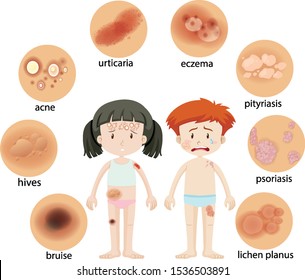 Different skin conditions on human girl and boy illustration