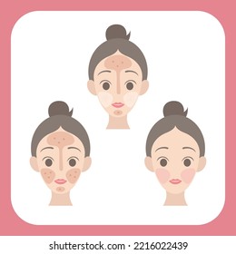 Different skin type of beauty girl. Girl take care her face for skin lifting. Vector illustration of the girl face.