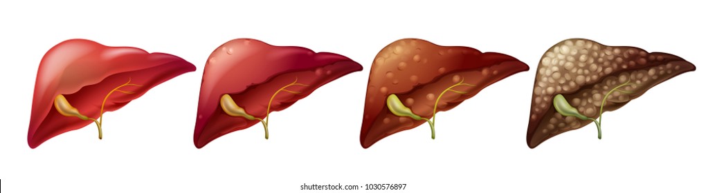 Different stages of human liver illustration