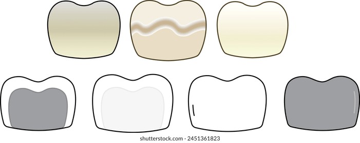 different type of Dental crown, dental treatment and tooth issue - flat illustration 