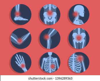 Different types of ache. Headache, abdominal pain and knee injury. Body and health care. Isolated vector illustration in cartoon style