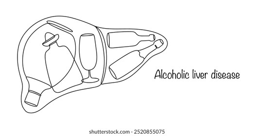 Diferentes tipos de alcohol dentro del hígado humano. Advertencia sobre los efectos negativos del consumo de alcohol en la salud. Enfermedades asociadas al consumo de alcohol. Ilustración vectorial.