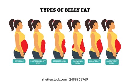 Diferentes tipos de colección de conjunto de grasa del vientre, diseño de póster de atención médica de grasa corporal con descripción detallada, grasa abdominal de mujer etiquetada, estómago, piernas. Estilo de vida poco saludable, concepto de dieta de pérdida de peso.