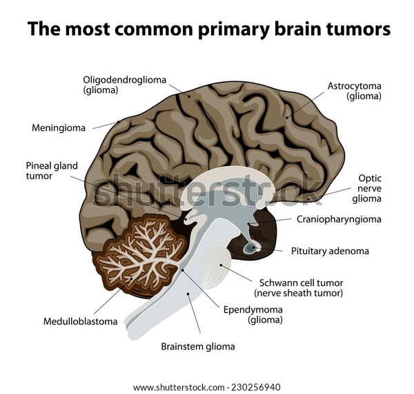 6-types-of-brain-disorders-ghp-news