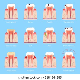 Diferentes tipos de enfermedad dental. Tratamiento de la cavidad oral. Dolor de muelas. Ilustración del vector